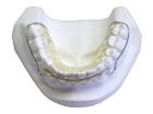 Retainer Hawleya - komplet