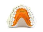 Retainer Begga