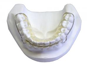 Retainer Hawleya - komplet